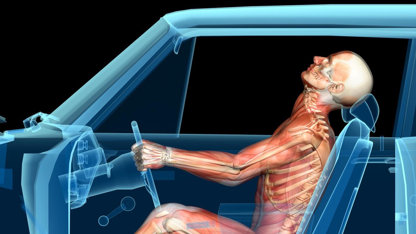 What To Do After a Rear End Car Accident?