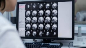 Athens Traumatic Brain Injury Attorney