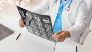 Austell Traumatic Brain Injury Attorney