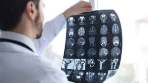 South Fulton Traumatic Brain Injury Lawyer